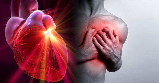 MSC Noticias - infarto.edicion2_0 Agencias Com y Pub Publicidad Salud 